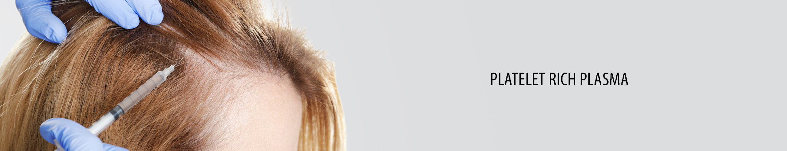 PRP Hair Treatment