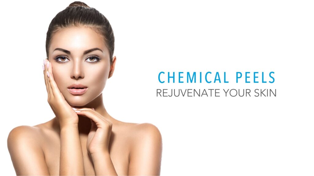 Chemical Peels
