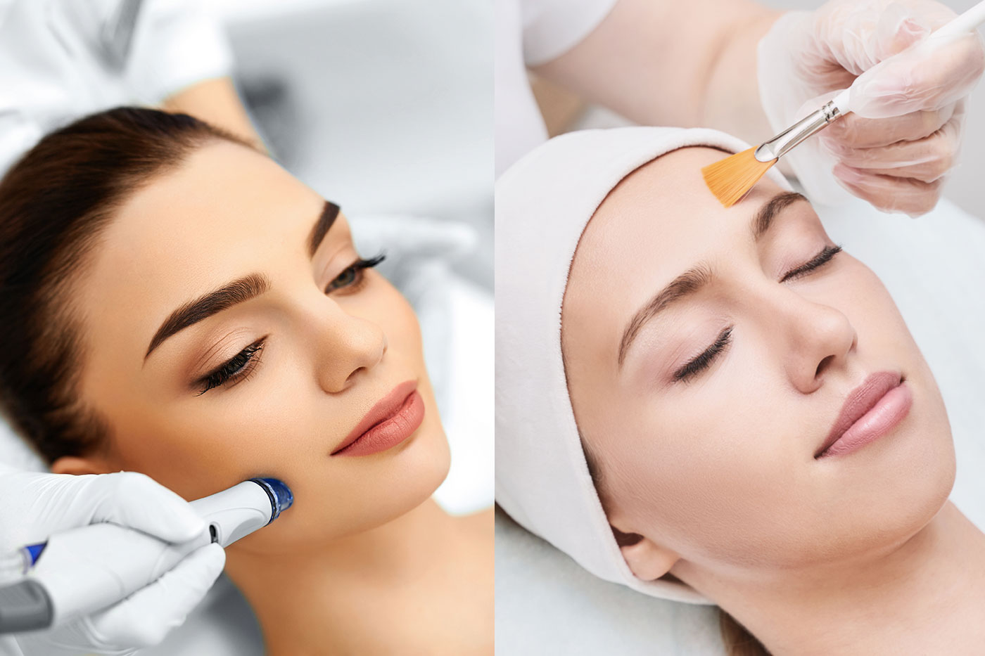 Chemical Peel for Hyperpigmentation: A Revolutionary Treatment for Brighter Skin