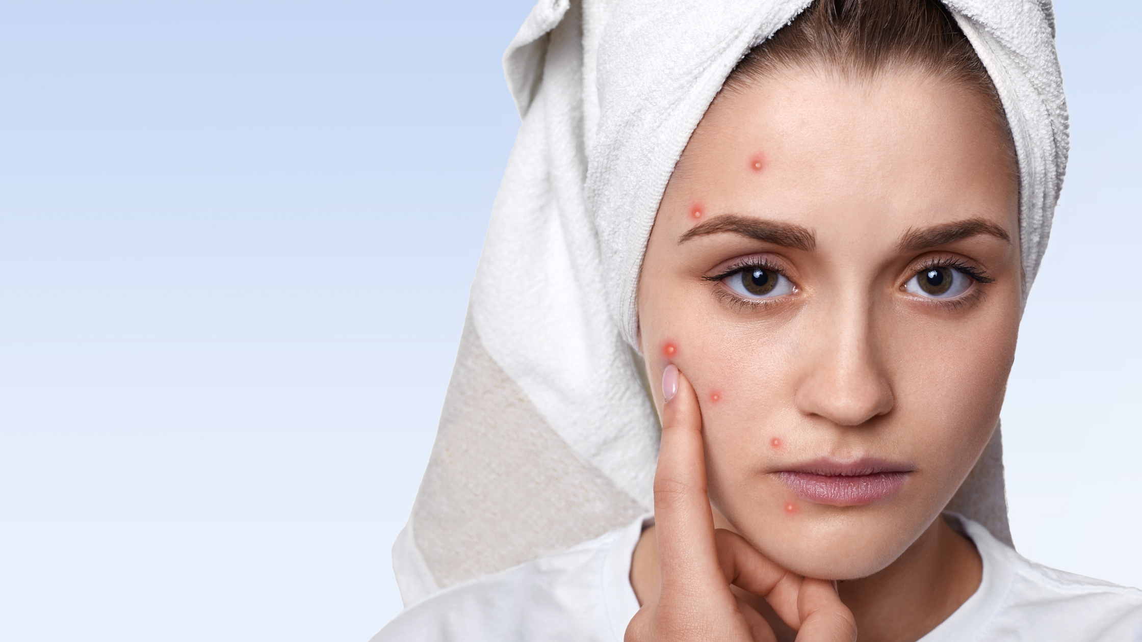 Pigmentation Problems? Here’s How Advanced Laser Treatments Help in Summer
